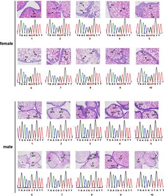 Application of SNP in Genetic Sex Identification and Effect of Estradiol on Gene Expression of Sex-Related Genes in Strongylocentrotus intermedius